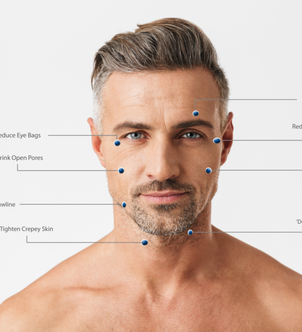 Focus-Dual-Male-Face-Treatment-Areas-Labelled-1024x683