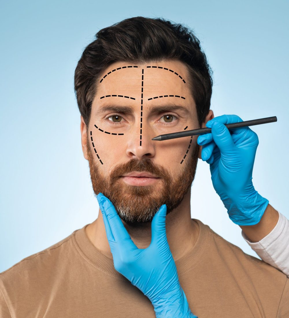 Plastic surgeon drawing marks on man's face for cosmetic surgery operation, handsome man posing on blue studio background, getting ready for aestetic operation or face lifting